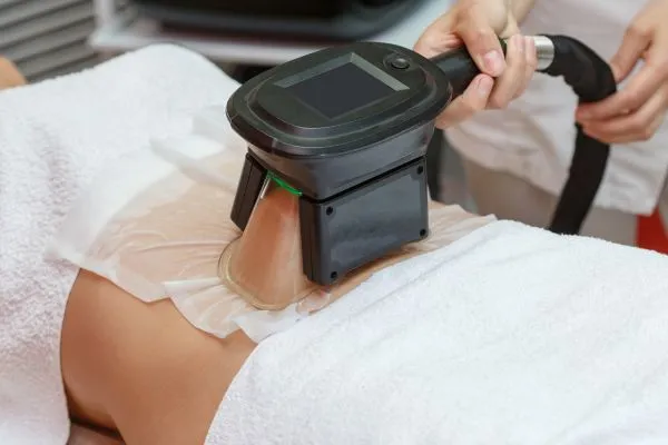Image of person having fat freezing treatment to help weight gain Sutton Coldfield