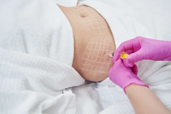 image of fat dissolving injections on love handles to help combat weight gain Sutton Coldfield