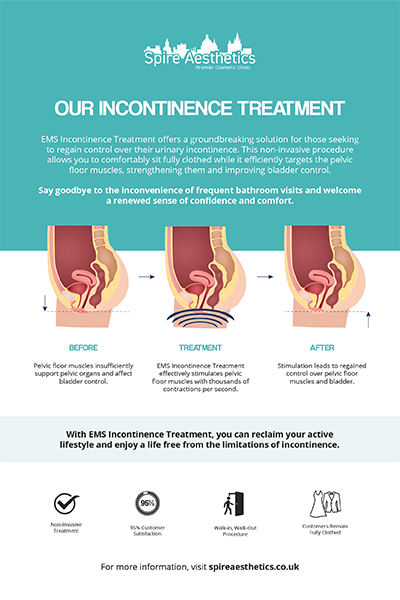 image to show how EMS treatment works for female urinary incontinence Sutton Coldfield