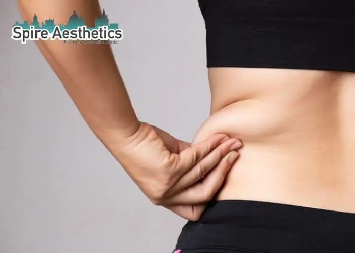 Image of woman pinching fat on their hips Sutton Coldfield. Fat Freezing treatment