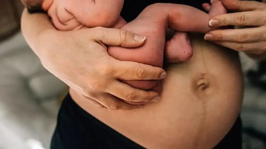 Why Is My Stomach Still Big After Pregnancy Sutton Coldfield?